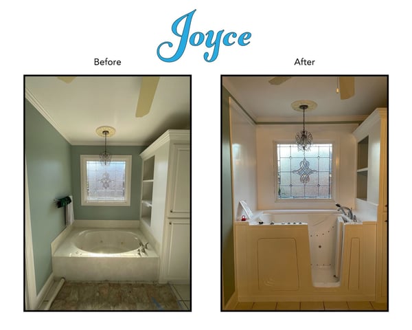 Before and After 20